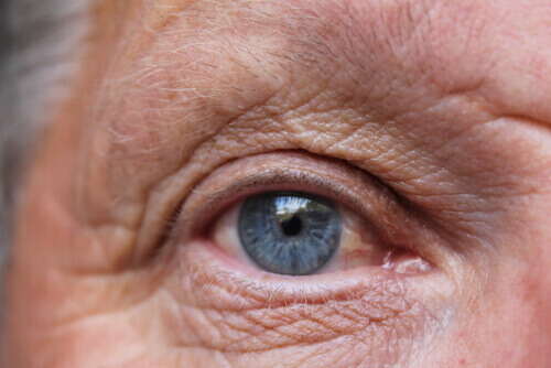 How Leaving Your Cataracts Untreated Can Affect Your Life